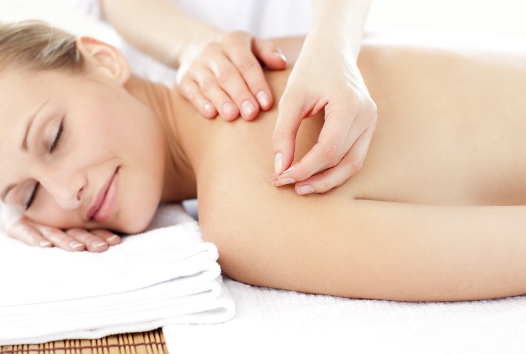 Fertility Acupuncture